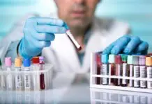 Dlaczego warto wykonać badania laboratoryjne